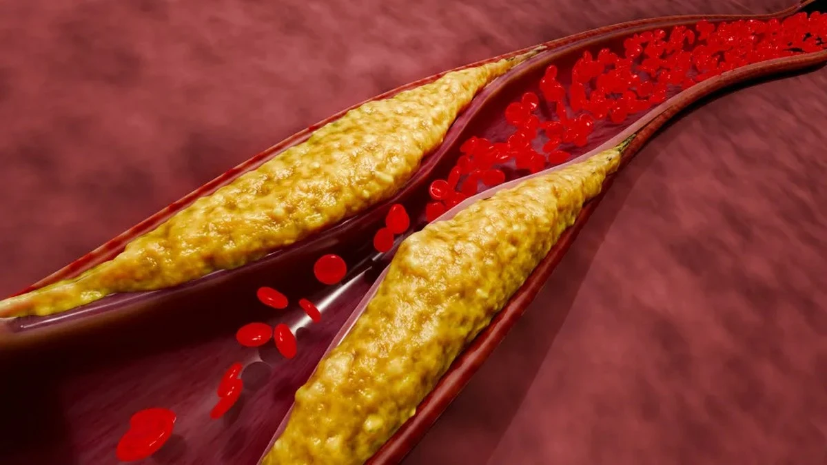 Dlaczego Twoje łydki pieką podczas spaceru? Kardiolog wskazuje na ukryty problem z tętnicami