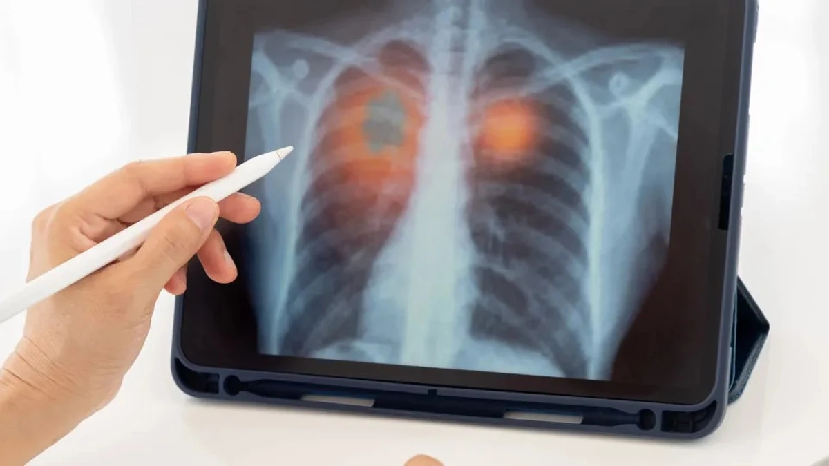 Dlaczego ponad 55 tysięcy diagnoz nowotworowych zniknęło w trakcie pandemii
