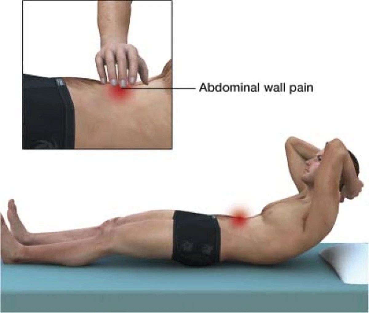 Dlaczego ten ból brzucha to nie jest zwykła niestrawność: sygnały, których nie wolno ignorować - image 1