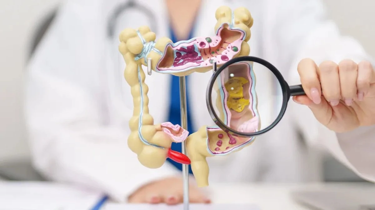 Pięć owoców, które warto mieć w kuchni, by lepiej chronić jelita