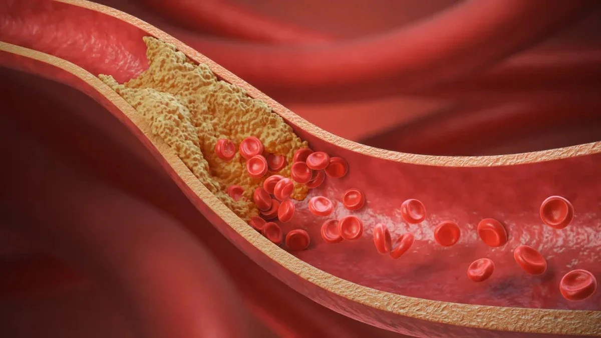 Te 10 produktów w twojej kuchni realnie obniżają poziom cholesterolu