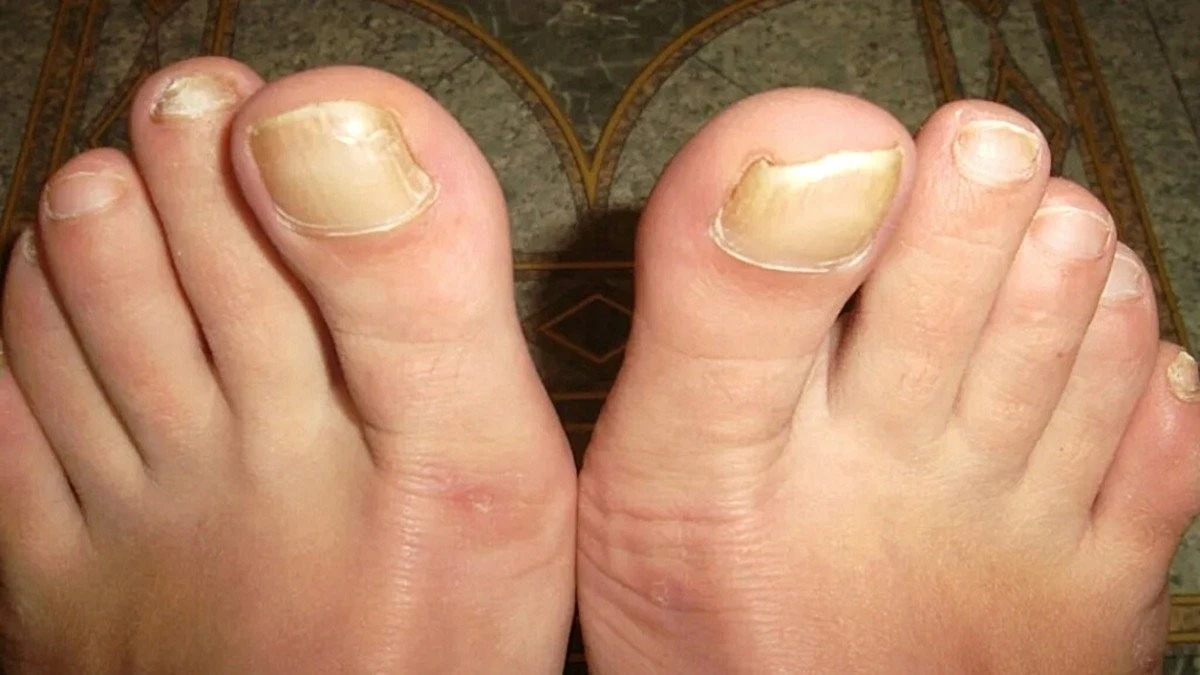 Zofia z Warszawy użyła suszarki do stóp: efekt po 7 dniach