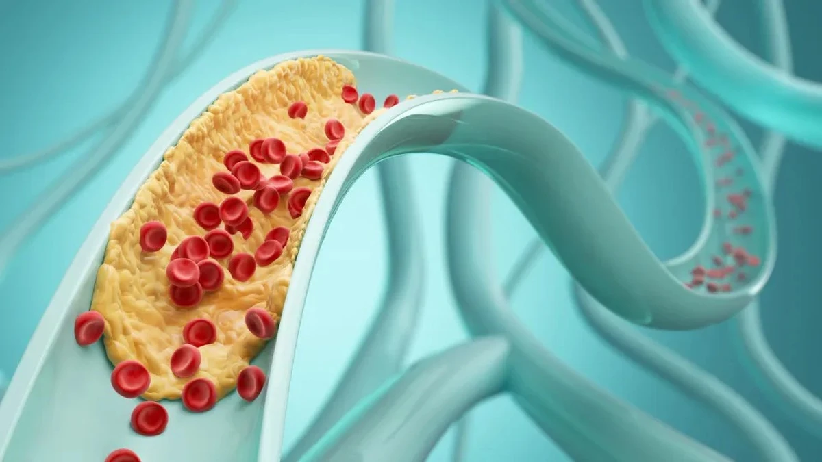 Cztery „złe” węglowodany, które w rzeczywistości obniżają cholesterol