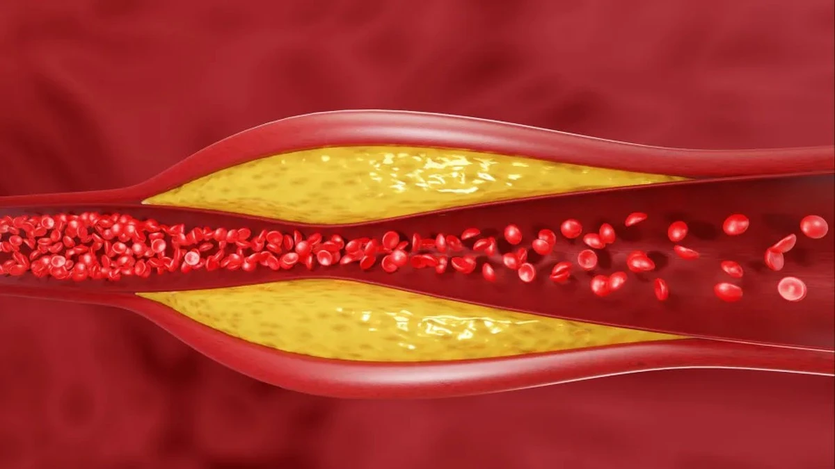 Produkty z puszki, które pomagają obniżyć poziom cholesterolu: opinia pielęgniarki
