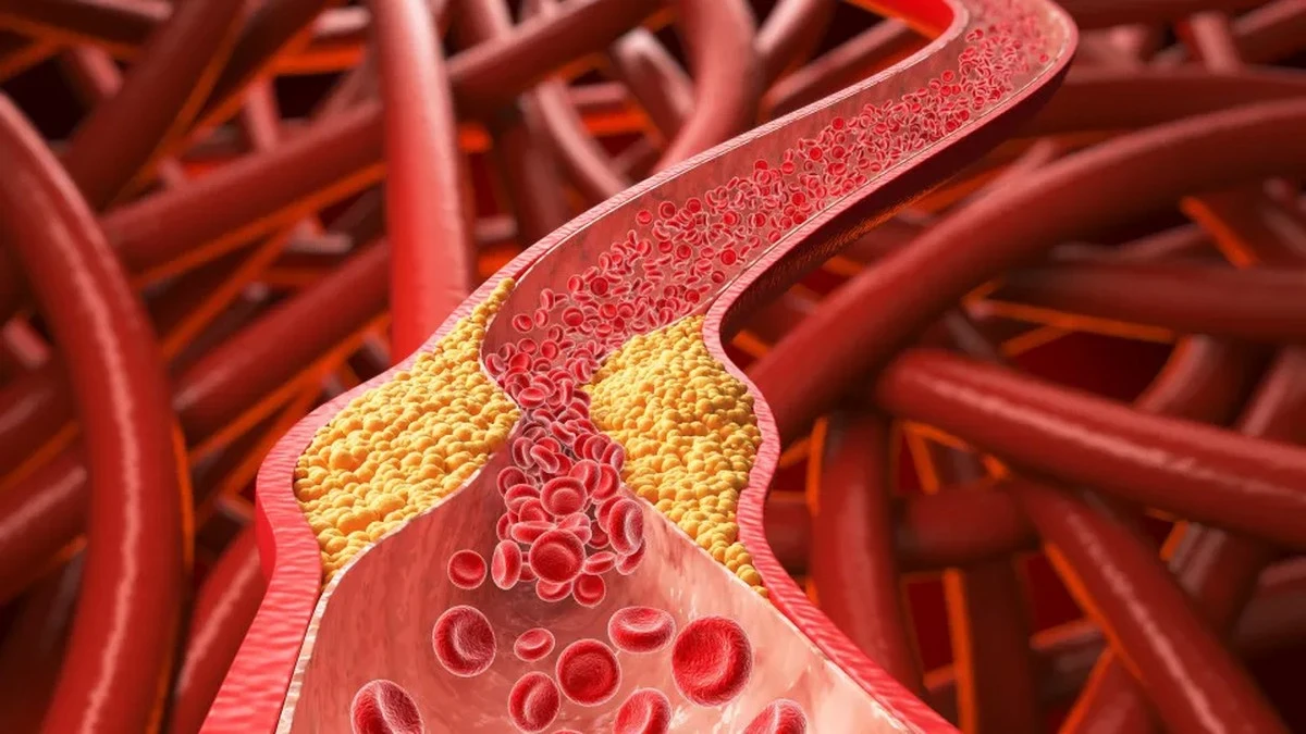 Dlaczego owsianka to za mało, aby trwale obniżyć cholesterol