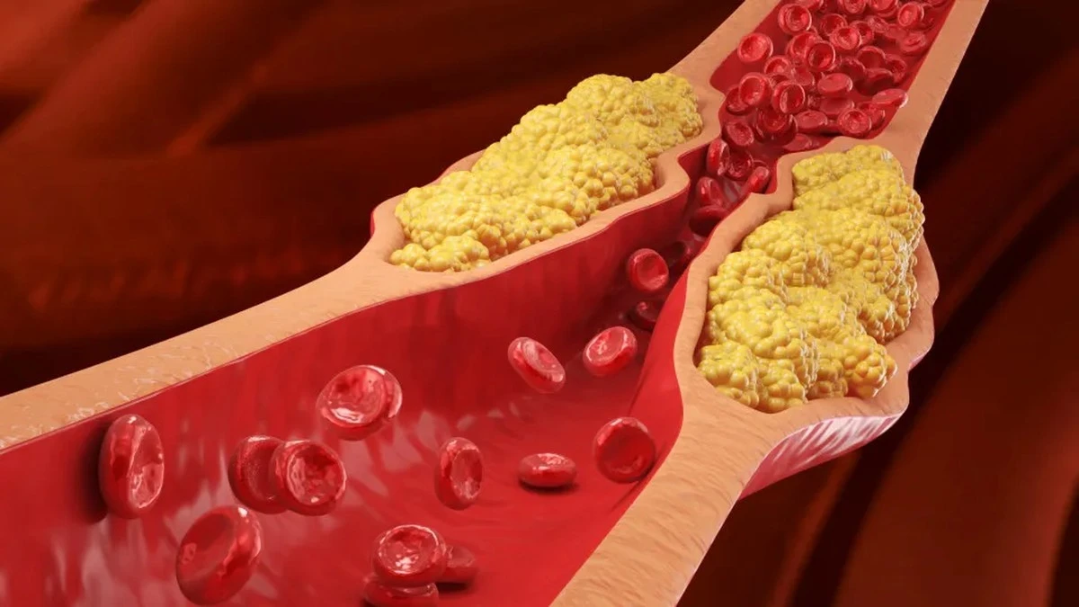 Pięć prostych nawyków, które realnie obniżają poziom cholesterolu