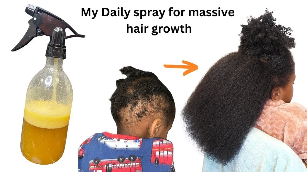 domowyspraynapo-extra-1.webp Domowy spray na porost włosów: ta mikstura zastępuje drogie kuracje - image 1