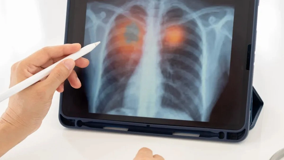 Zdrowa dieta a nowotwór płuc: czy to możliwe, że jemy zbyt zdrowo?