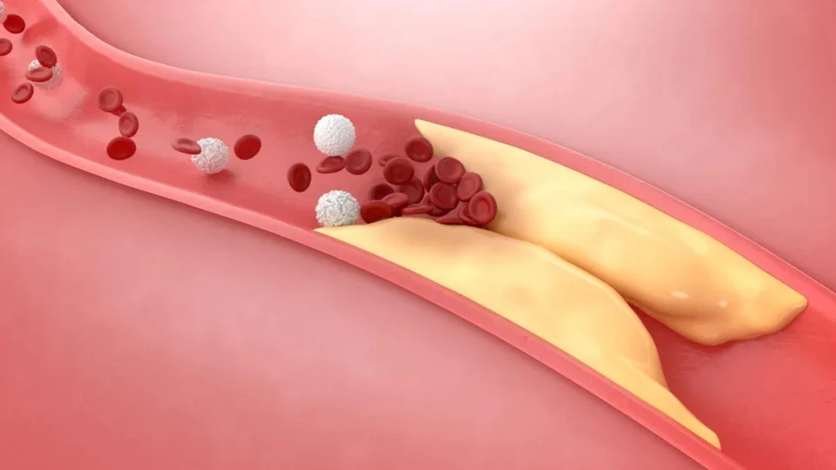 Pięć produktów, które nieświadomie podnoszą twój poziom cholesterolu