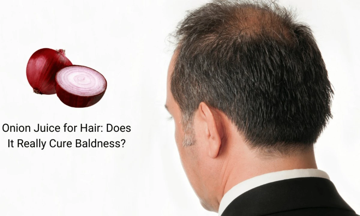 dlaczegocebulab-extra-1.webp Dlaczego cebula bije na głowę drogie sera: 1 trik na włosy - image 1