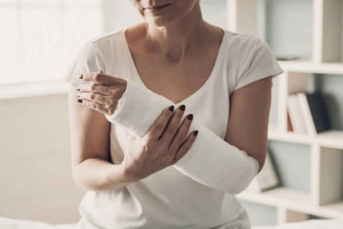 Złamanie ręki: jak przyspieszyć zrost kości i wrócić do pełnej sprawności - image 1