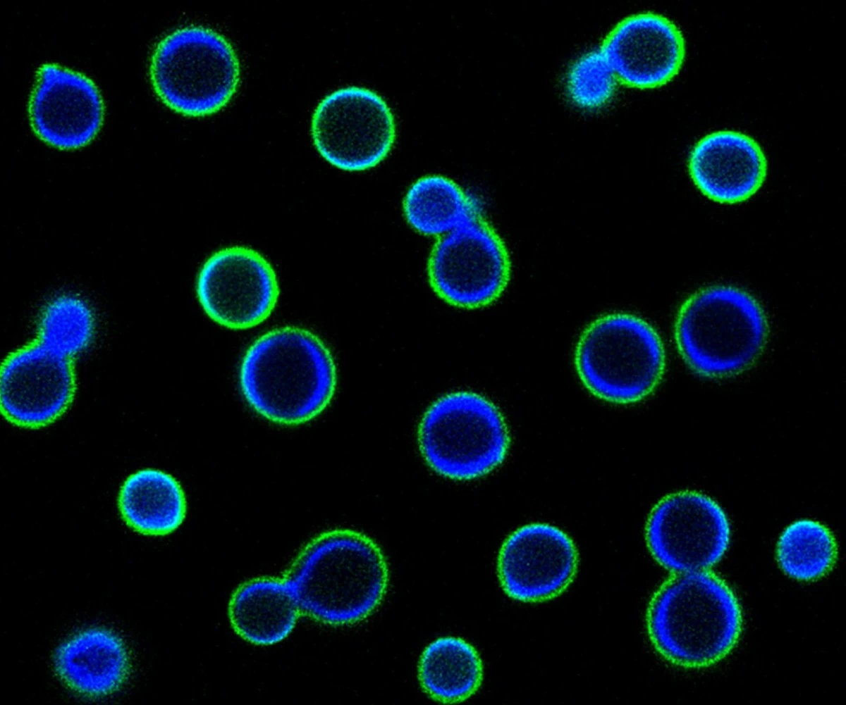 dlaczegoswiatmo-extra-1.webp Dlaczego świat może stracić wyjątkowe gatunki grzybów, o których istnieniu nawet nie wiemy - image 1