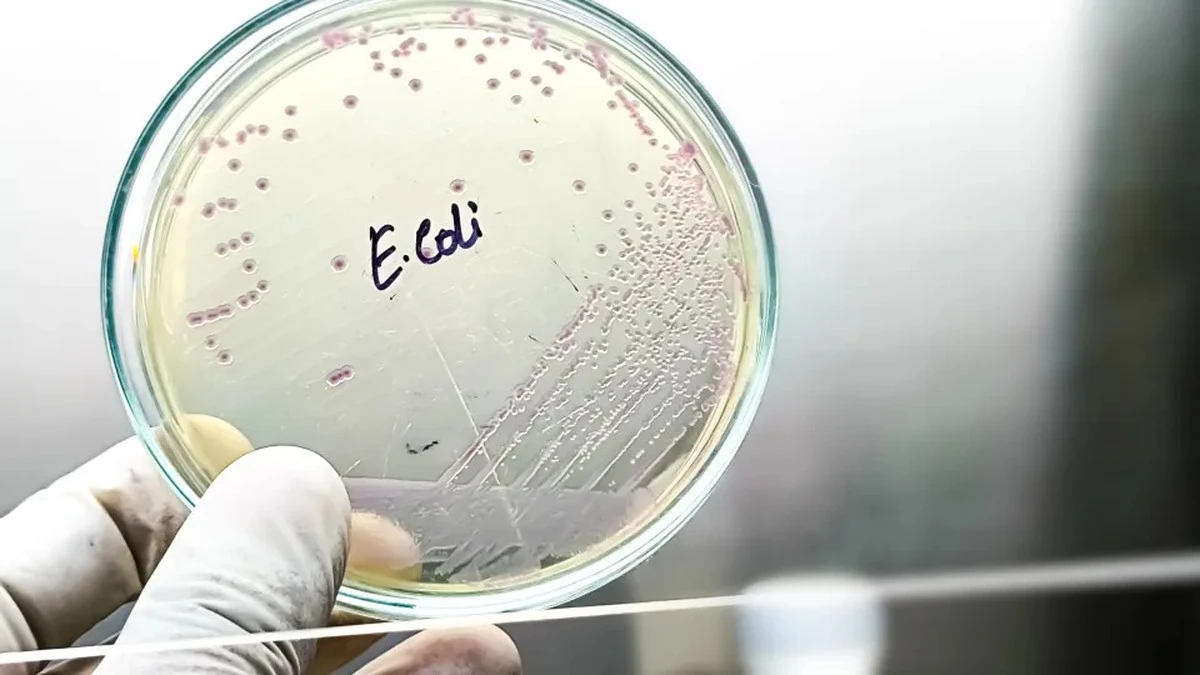 Zielony symbol zdrowia? Te 3 produkty najczęściej przenoszą E. coli