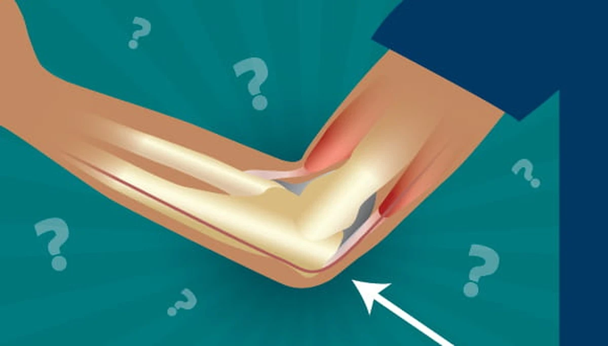 Dlaczego dotknięcie łokciem o kant stołu wywołuje „impuls elektryczny” - image 1