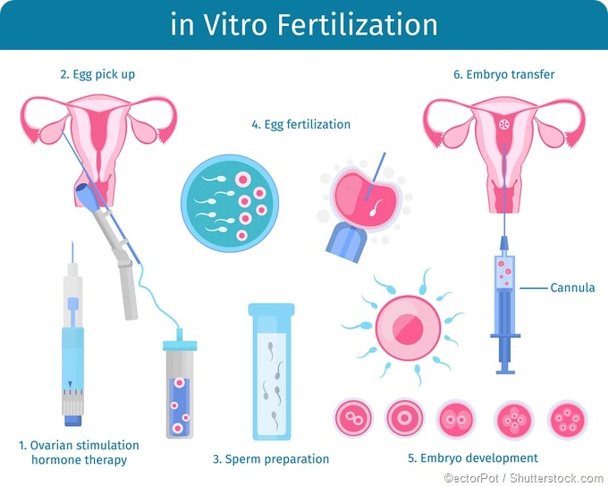 Prawda o procedurze in vitro: co Maria Botelho Moniz ujawniła na temat swojej walki o macierzyństwo - image 1